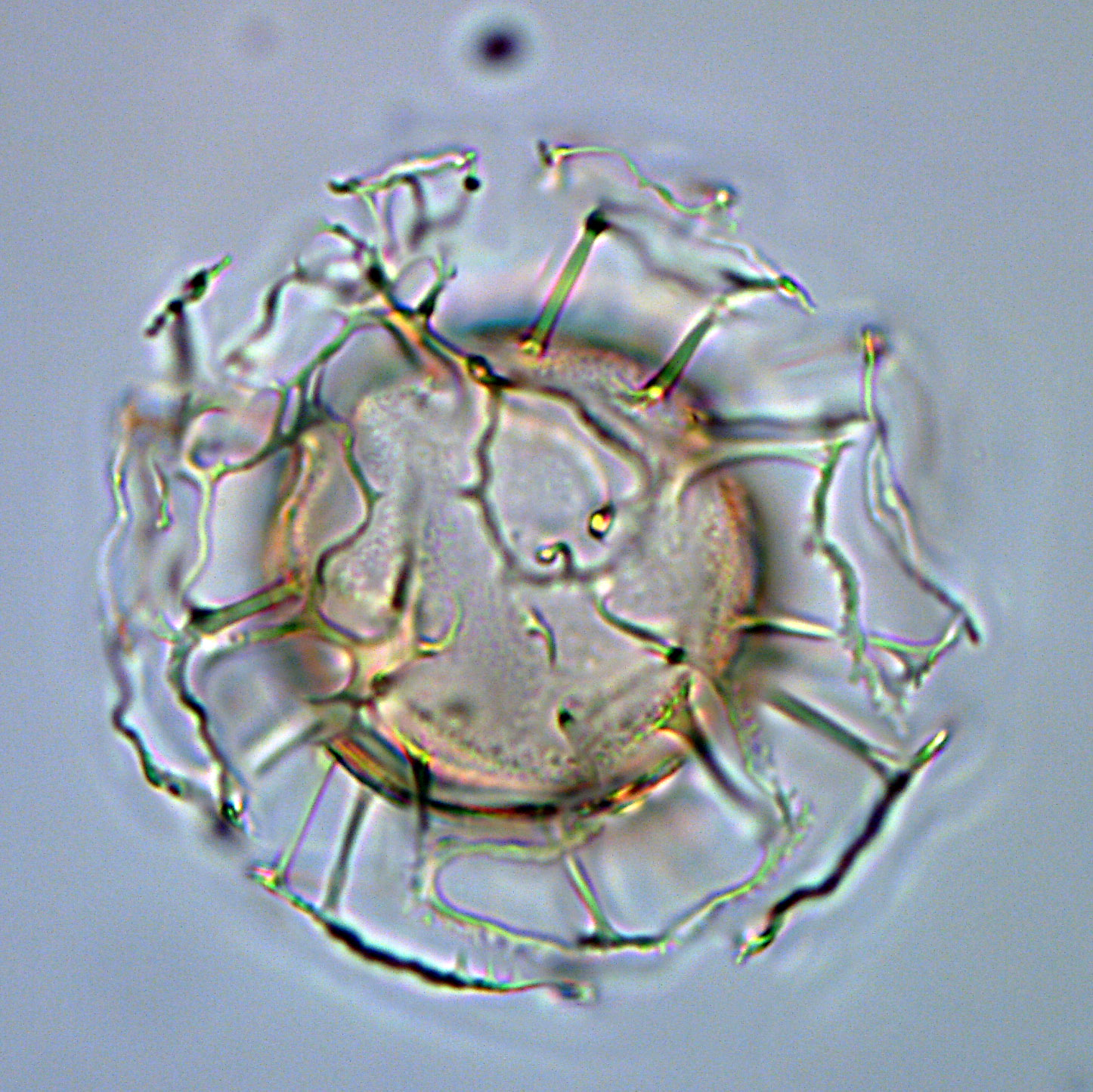 Emmetrocysta sp., 1410C-9H-4, 15-17, F28, foto-f.jpg